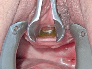 妻は歯ブラシで彼女の他の穴をマスターベーションし、彼女の膀胱に長い鎖を挿入します